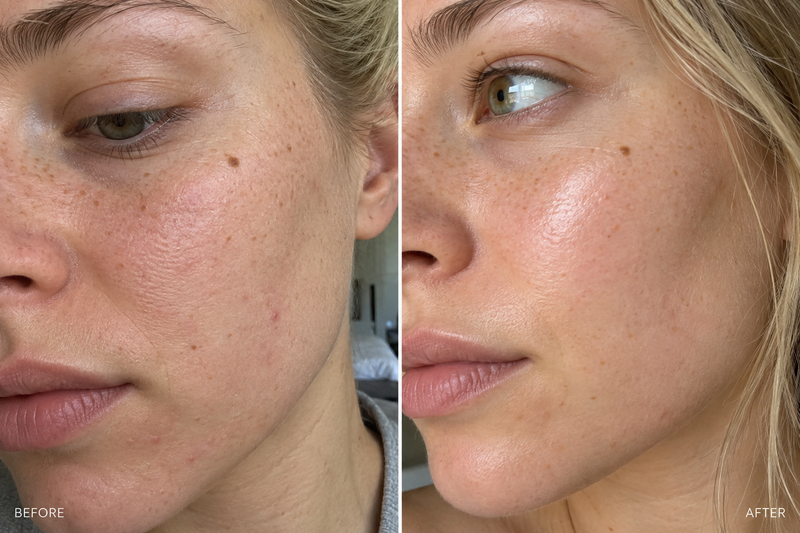 Beauty Bloom customer before and after skin appearance comparison 14