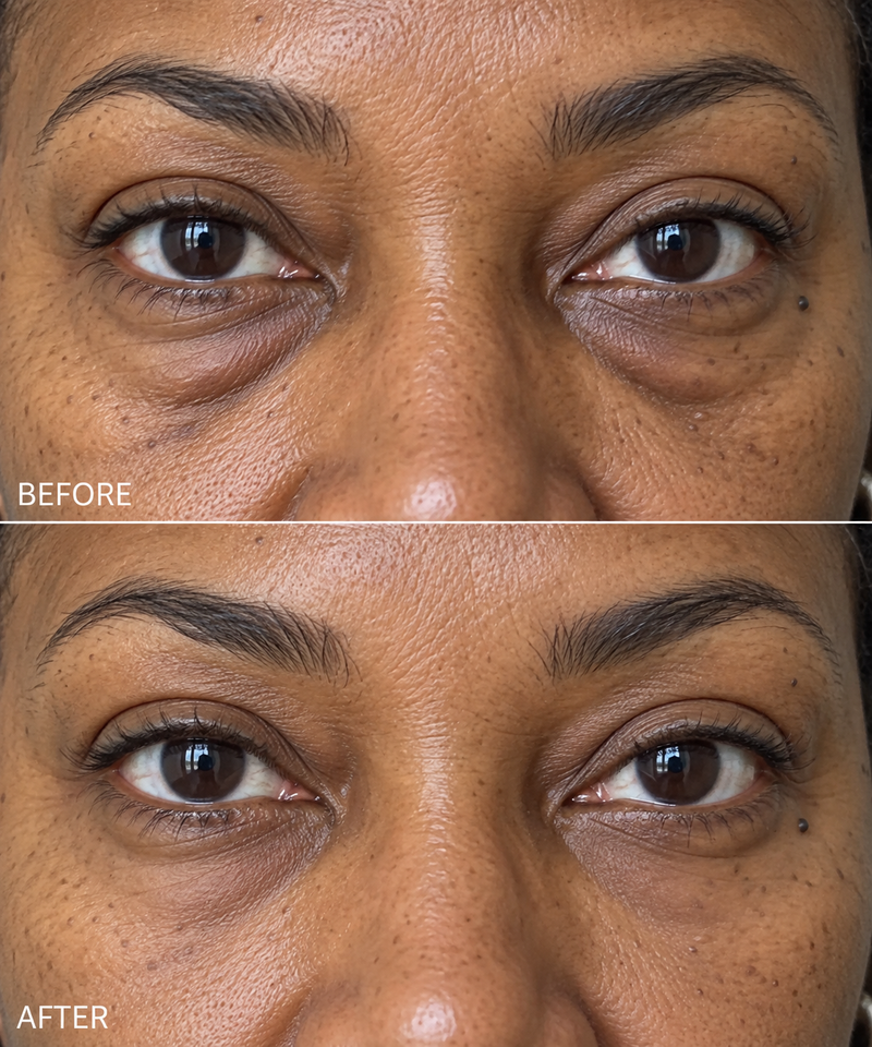 Before and after comparison 1