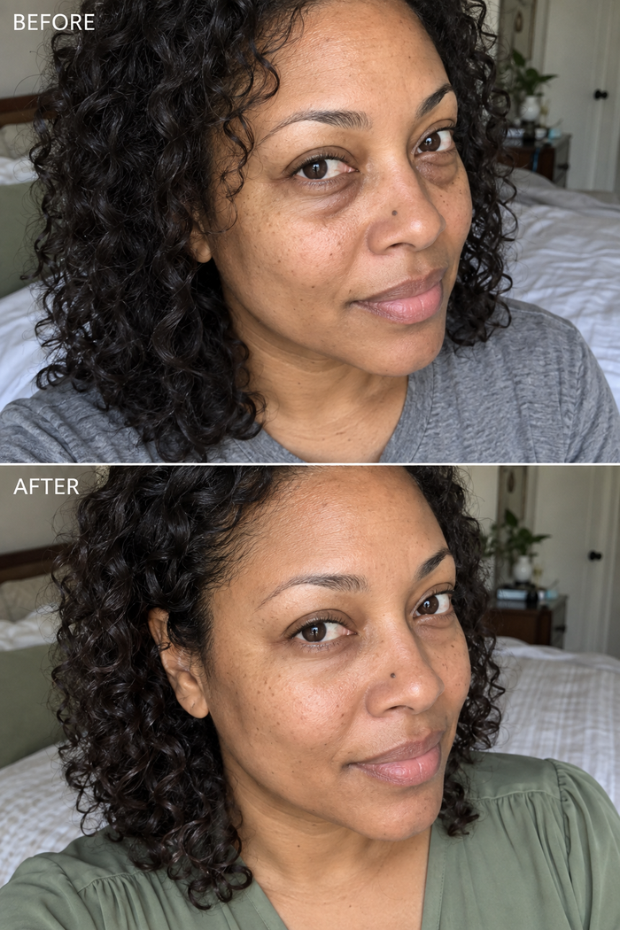 Before and after face comparison — customer experience
