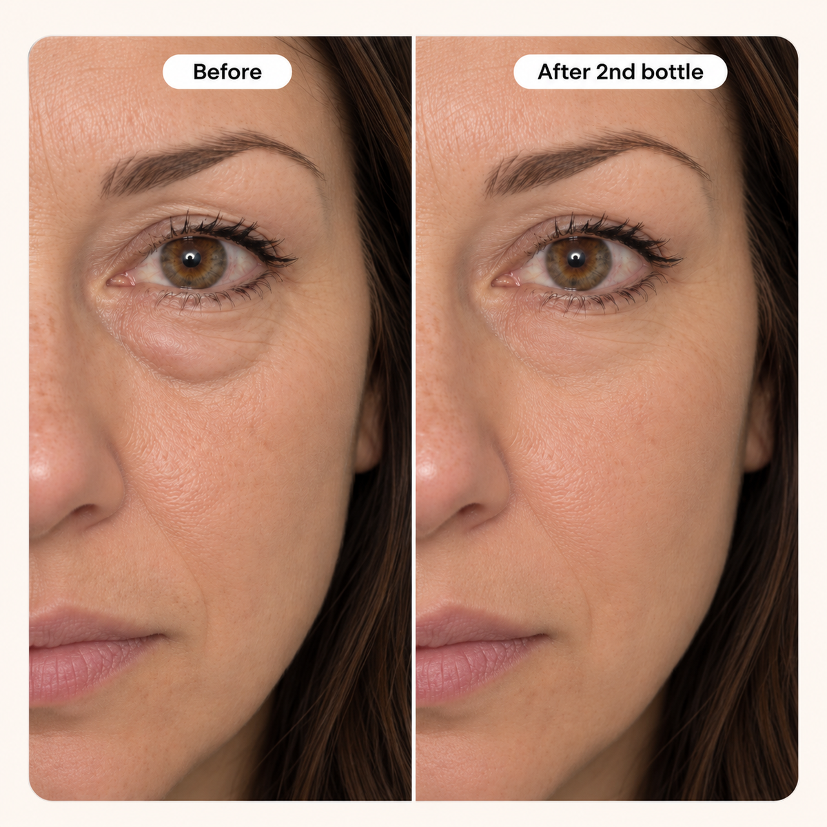 Customer-submitted Peptide Under-Eye Cream comparison: Before and After 2nd bottle
