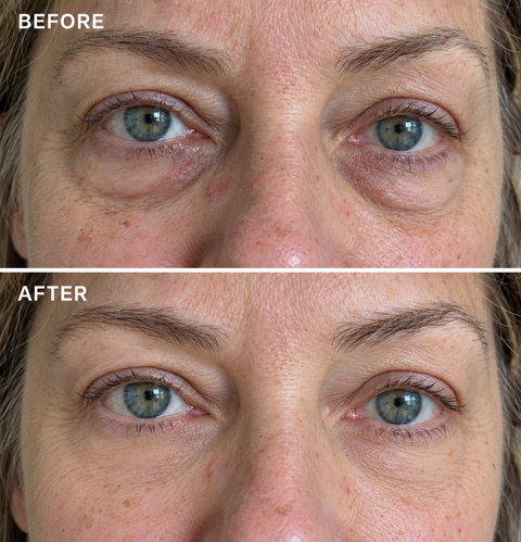 Before-and-after eye-area photo supplied with the review “My under-eyes look years better.”