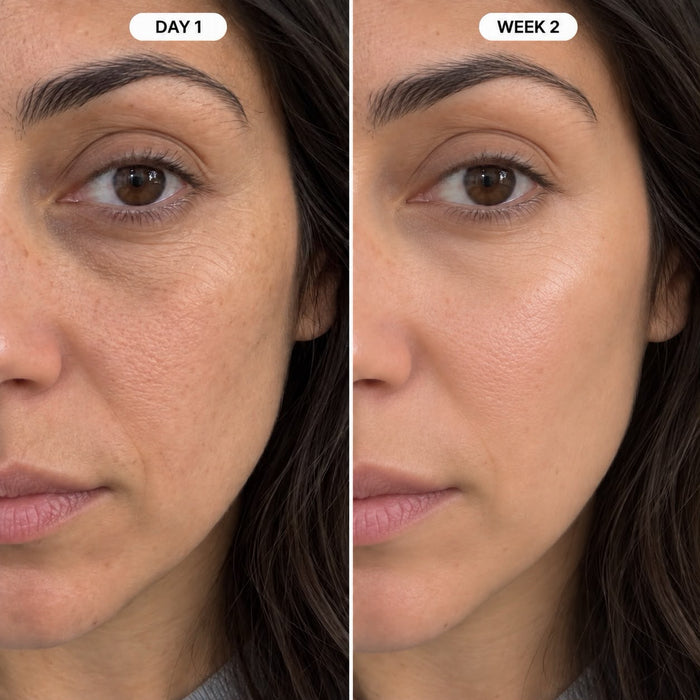 Customer-provided Peptide Under-Eye Cream review photo, labeled Day 1 and Week 2.